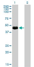 Monoclonal Mouse anti-Human ARA55 / HIC-5 Antibody (clone 4B2-D8, WB)