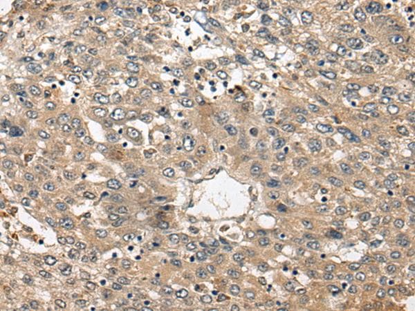 FUT4 / CD15 Antibody