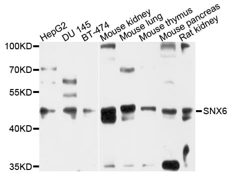 Polyclonal Rabbit anti-Human SNX6 Antibody (WB)