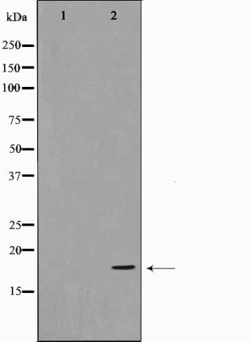 Polyclonal Rabbit anti-Human CFL2 / Cofilin 2 Antibody (IF, WB)