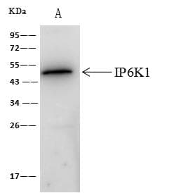 IP6K1 Antibody (Preservative Free)