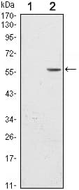 CD276 / B7-H3 Antibody (clone 6A1)