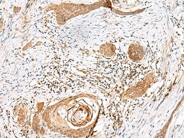 GSTM1 Antibody