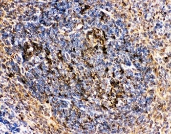 Polyclonal Rabbit anti-Human MME / CD10 Antibody (aa52-750, IHC, WB)