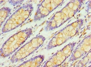 RBX1 / ROC1 Antibody (aa1-108)