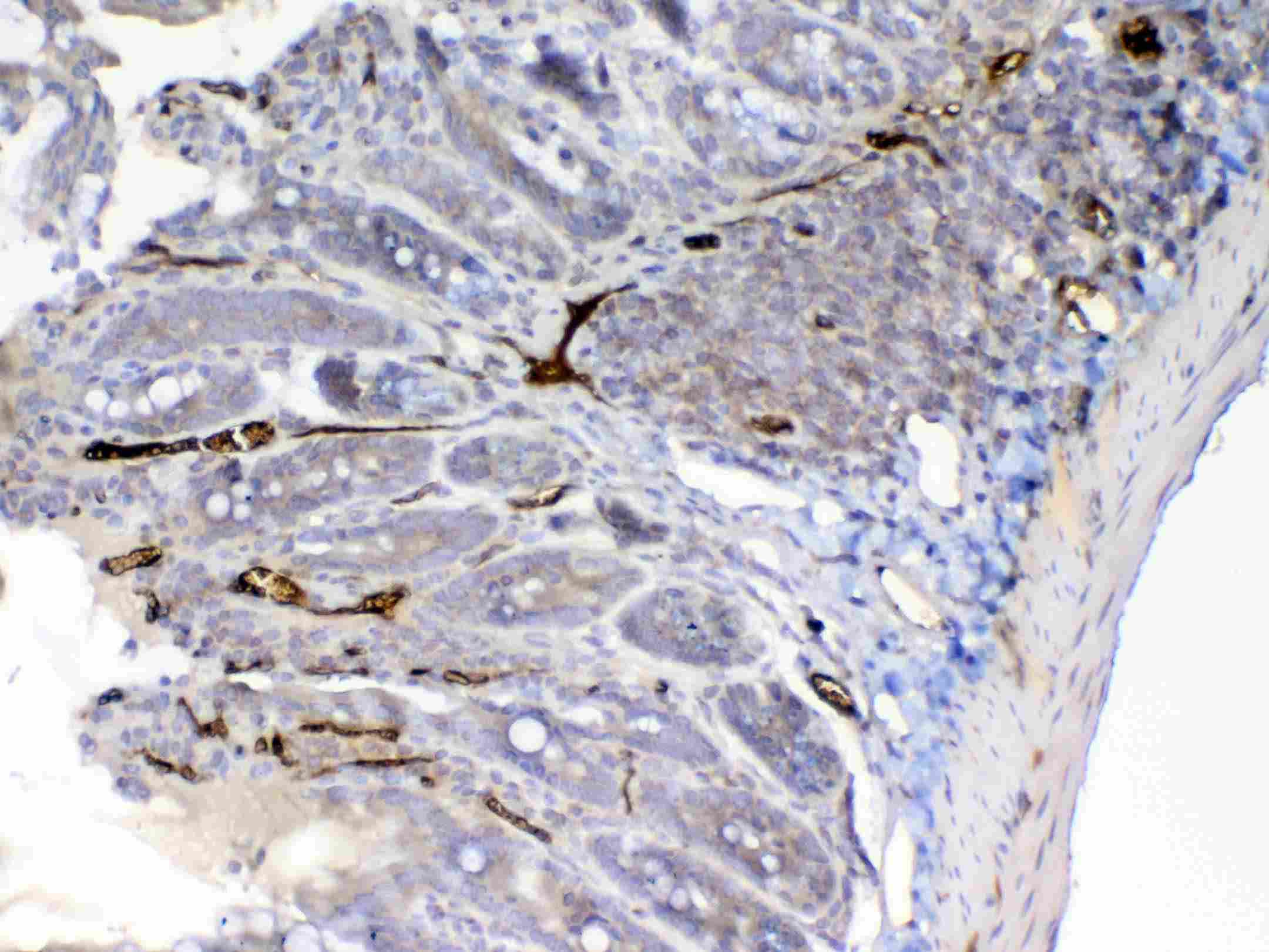 CFD / Factor D / Adipsin Antibody
