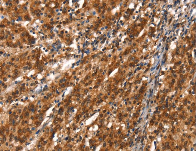 Polyclonal Rabbit anti-Human CYP2D6 Antibody (IHC)