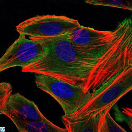 RPS6KA3 / RSK2 Antibody