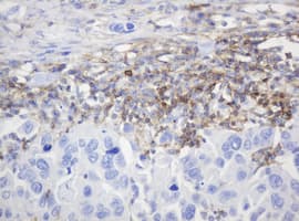Monoclonal Mouse anti-Human CD99 Antibody (clone OTI13B3, IHC, WB)