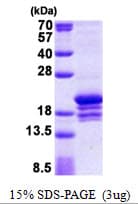 Human POLE3 / DNA Polymerase Epsilon Protein (Recombinant His)
