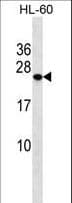 Polyclonal Rabbit anti-Human PCTP Antibody (aa59-87, WB)