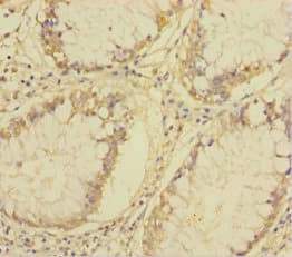 Polyclonal Rabbit anti-Human LP-PLA2 / PLA2G7 Antibody (WB)