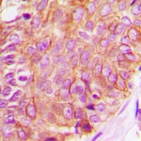 Polyclonal Rabbit anti-Human RAF1 / RAF Antibody (N-Terminus, IHC, WB)