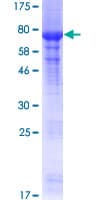 Human PRMT2 Protein (Recombinant GST)