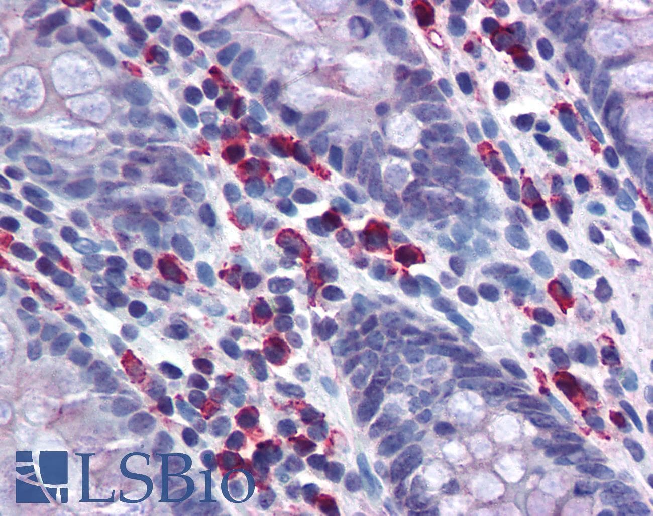 IHC-plus™ Polyclonal Rabbit Anti-Human Lambda Light Chain Secondary Antibody (IHC)
