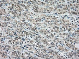 Monoclonal Mouse anti-Human BUB1B / BubR1 Antibody (clone OTI10B7, IHC, IF, WB)