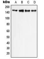 Polyclonal Rabbit anti-Human PLCG1 Antibody (C-Terminus, IF, WB)
