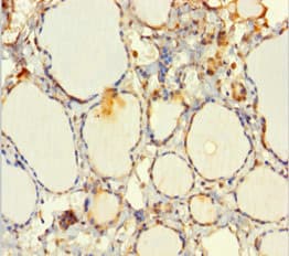 EML2 / EMAP2 Antibody (aa1-418)