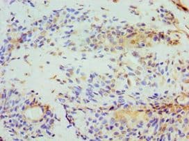 Polyclonal Rabbit anti-Human STOM / Stomatin Antibody (aa55-288, IHC, WB)