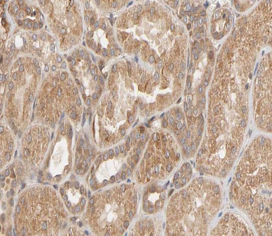 HSPB1 / HSP27 Antibody (phospho-Ser82)