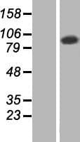 TATDN2 Protein (Over-Expression Lysate Myc-DDK (Flag))