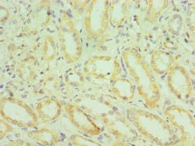 HYAL2 Antibody (aa367-473)