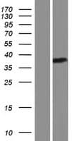 EPHA6 / EPH Receptor A6 Protein (Over-Expression Lysate Myc-DDK (Flag))