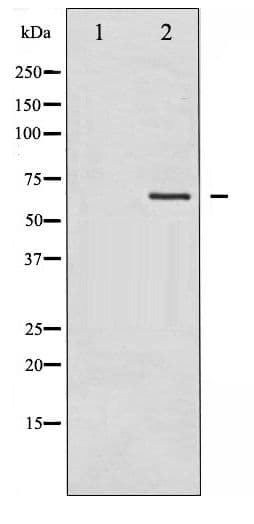 LIMK2 Antibody (phospho-Ser283)