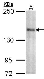 CACNA1S / Cav1.1 Antibody (aa544-885)