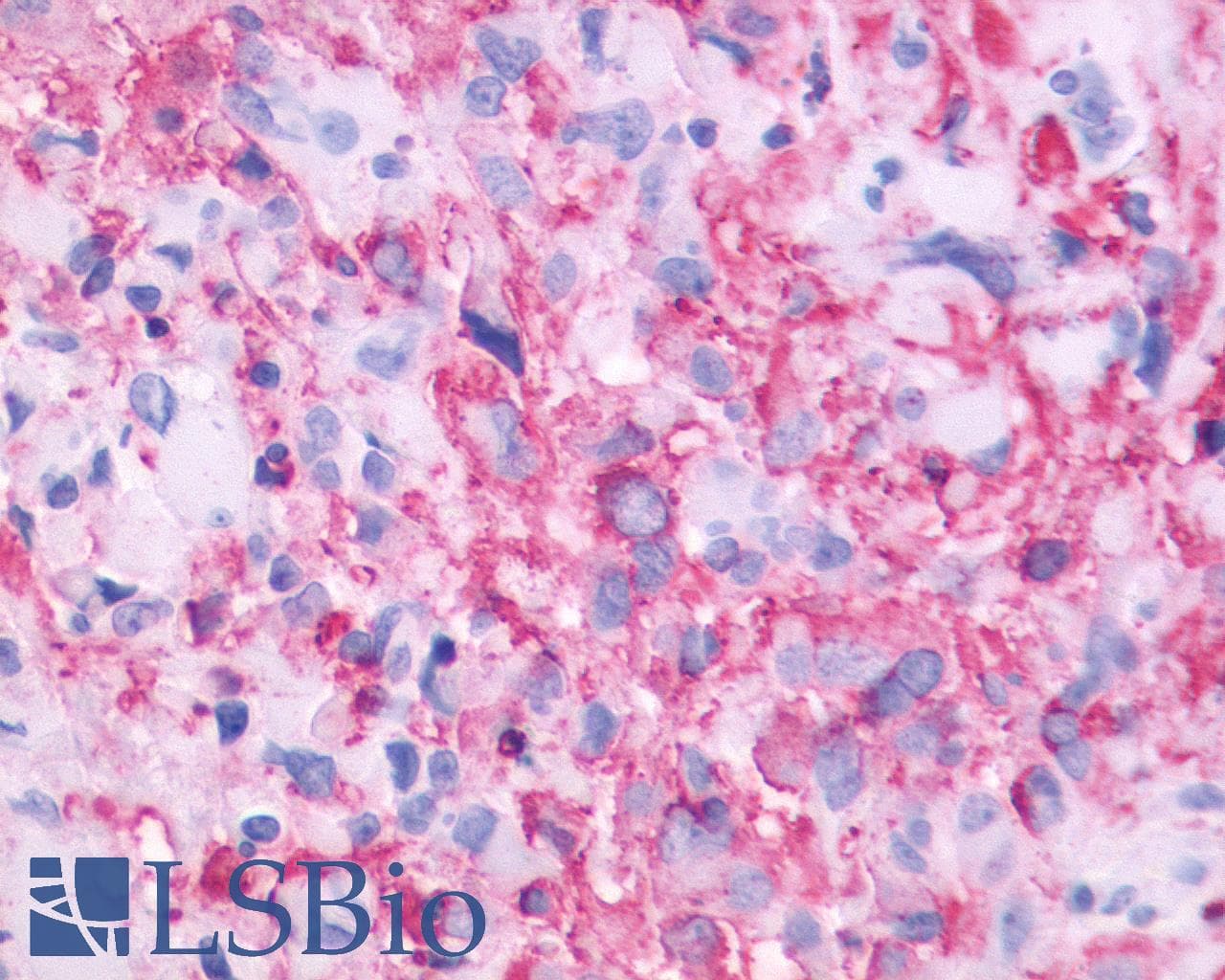 PathPlus™ GPR143 Antibody (C-Terminus)
