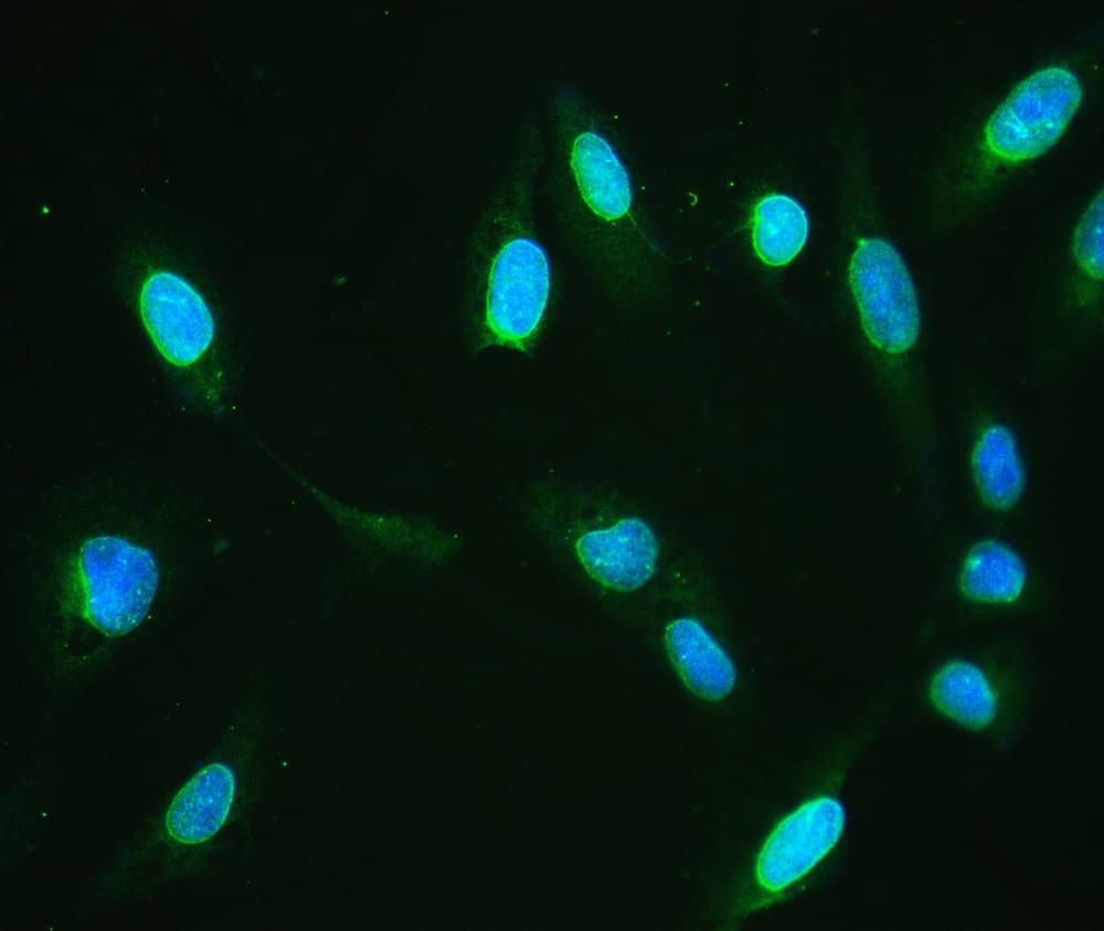 Polyclonal Rabbit anti-Human EMD / Emerin Antibody (IHC, WB)