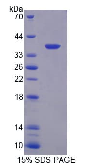 Rat OXTR / Oxytocin Receptor Protein (Recombinant His-GST)