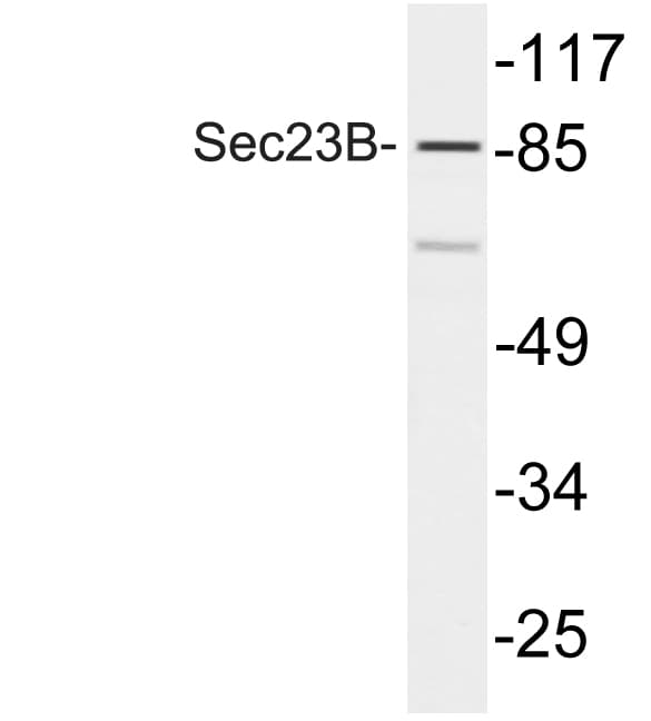 SEC23B Antibody (Val544)