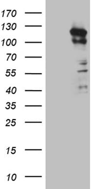 Monoclonal Mouse anti-Human PKN3 Antibody (clone OTI11D8, aa1-275, WB)