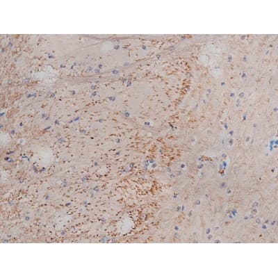MAPT / Tau Antibody (phospho-Ser214)