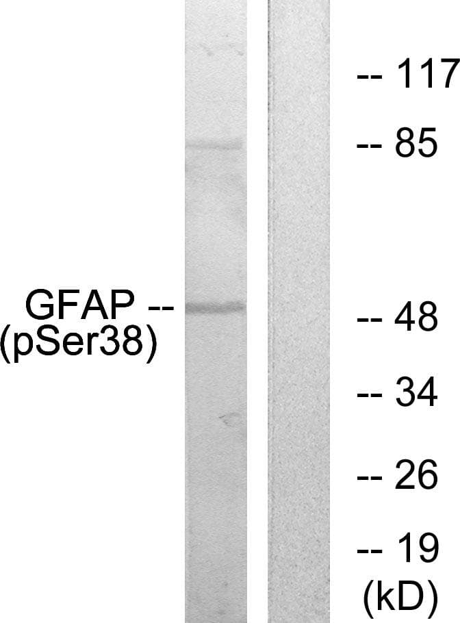 GFAP Antibody (phospho-Ser38)