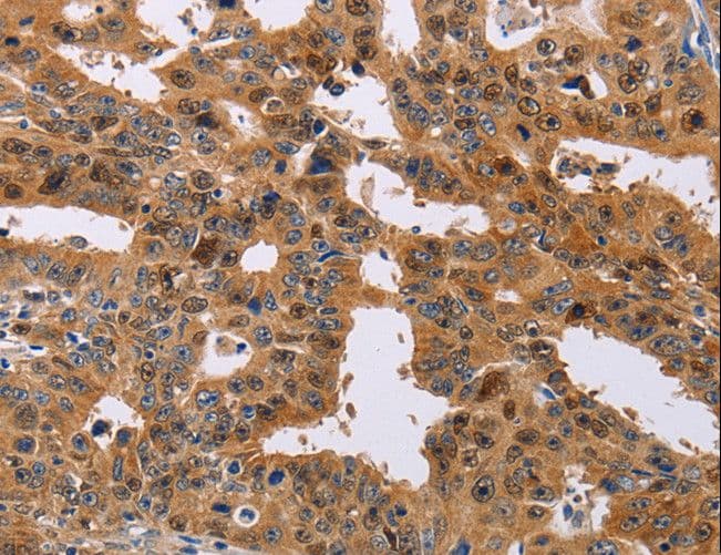 Polyclonal Rabbit anti-Human ALS2CR1 / NIF3L1 Antibody (IHC)
