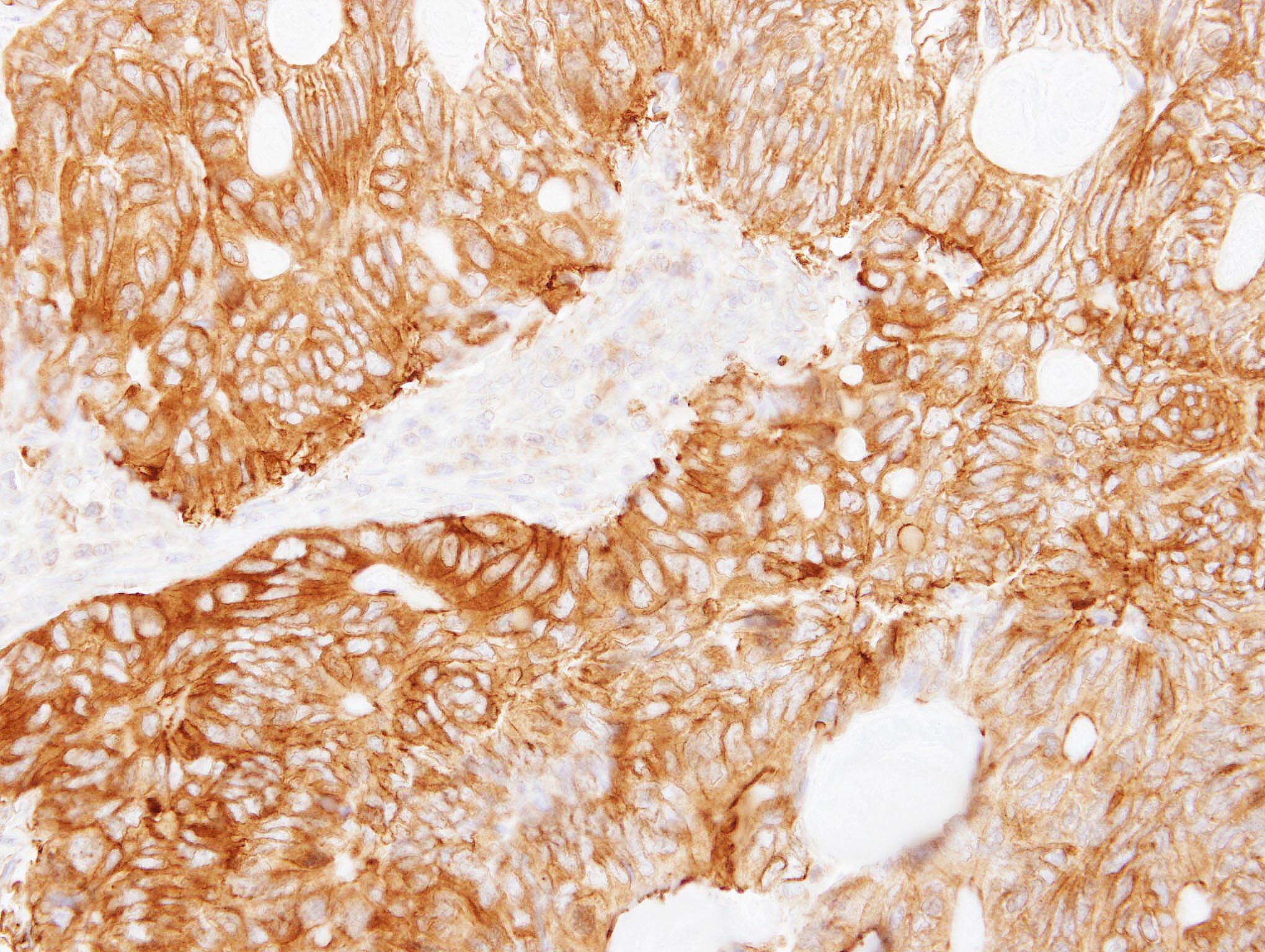 LAD1 Antibody (aa300-517)