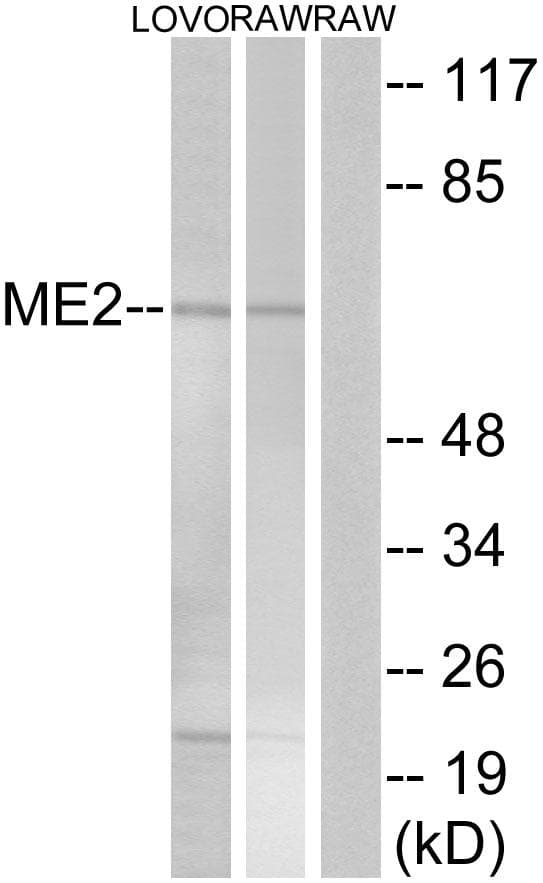 ME2 / Malate Dehydrogenase 2 Antibody