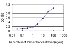 ZAP70 Antibody (clone 2F6)
