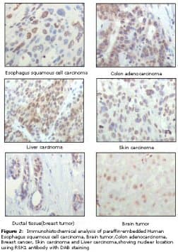 RPS6KA1 / RSK1 Antibody (clone 10B1D7A9, 10B1D7E12)