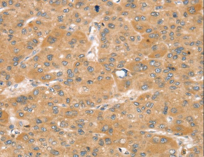 SNX2 Antibody