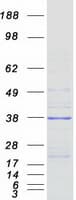 Human VPS37B Protein (Recombinant Myc-DDK (Flag))