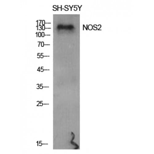 PathPlus™ NOS2 / iNOS Antibody (90-170 aa)