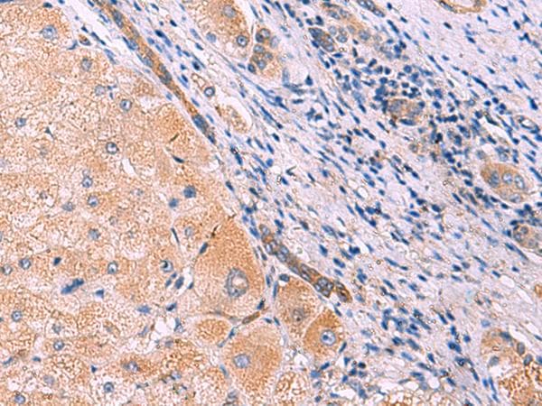 MYOT / Myotilin Antibody