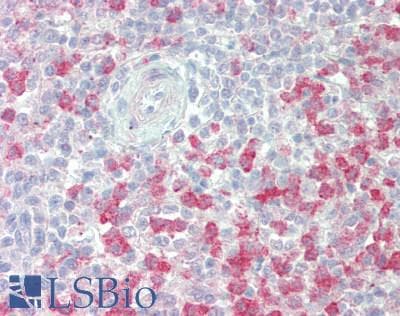 IHC-plus™ TMEM47 Antibody
