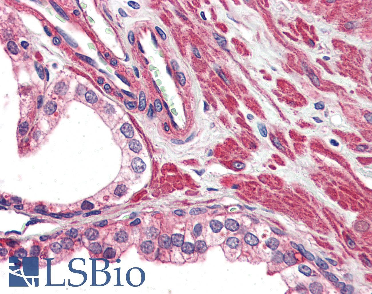IHC-plus™ VRL1 / TRPV2 Antibody (Internal)