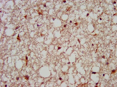 MC3R / MC3 Receptor Antibody