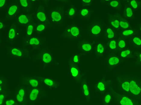 Polyclonal Rabbit anti-Human MSH6 Antibody (IHC, IF, WB)