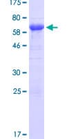 Human ATXN3 / JOS Protein (Recombinant GST)